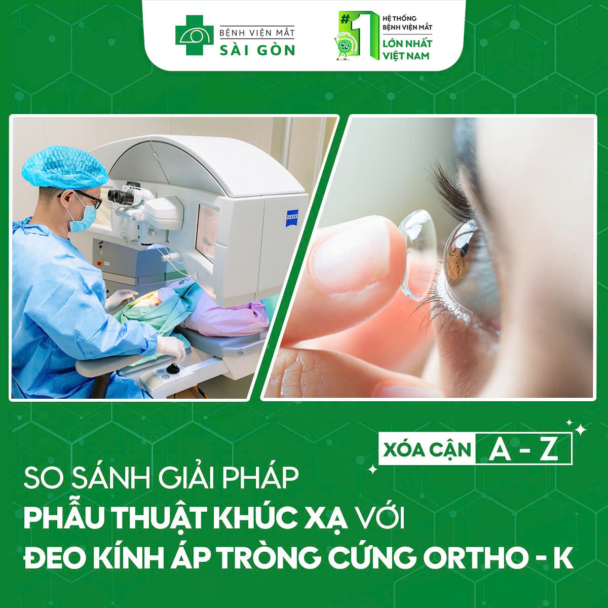 SO SÁNH GIẢI PHÁP ĐEO KÍNH ÁP TRÒNG CỨNG ORTHO-K VỚI PHẪU THUẬT KHÚC XẠ