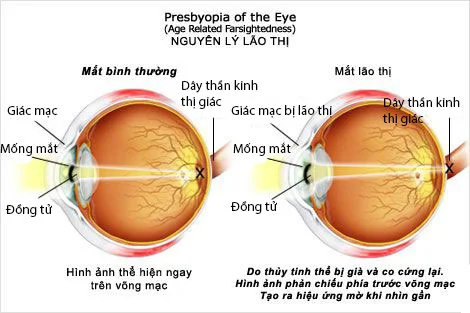 lão thị