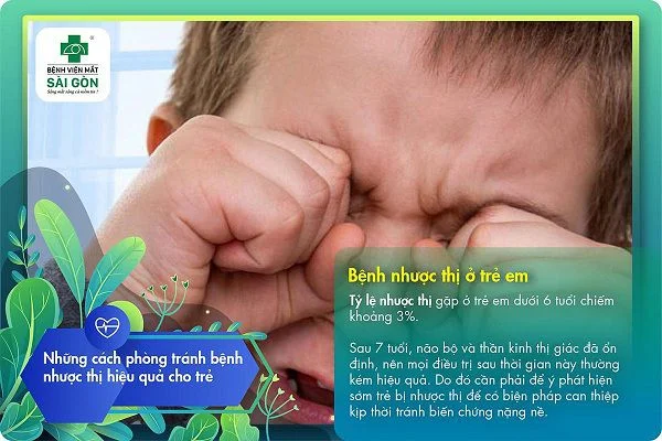 Bệnh nhược thị ở trẻ em 
