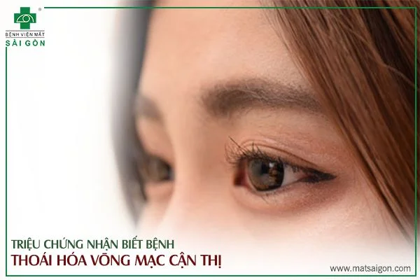 thoái hoá võng mạc